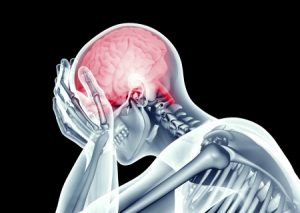 Concussion-Symptoms